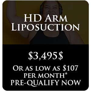 HD Arm Liposuction HD Arm Liposuction