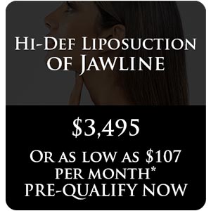 Hi-Def Liposuction of Jawline Hi-Def Liposuction of Jawline