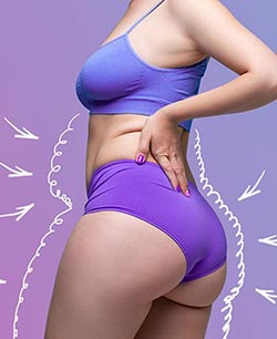 Cellulite Treatment Near Me in Schaumburg, IL Cellulite Treatment Near Me in Schaumburg, IL