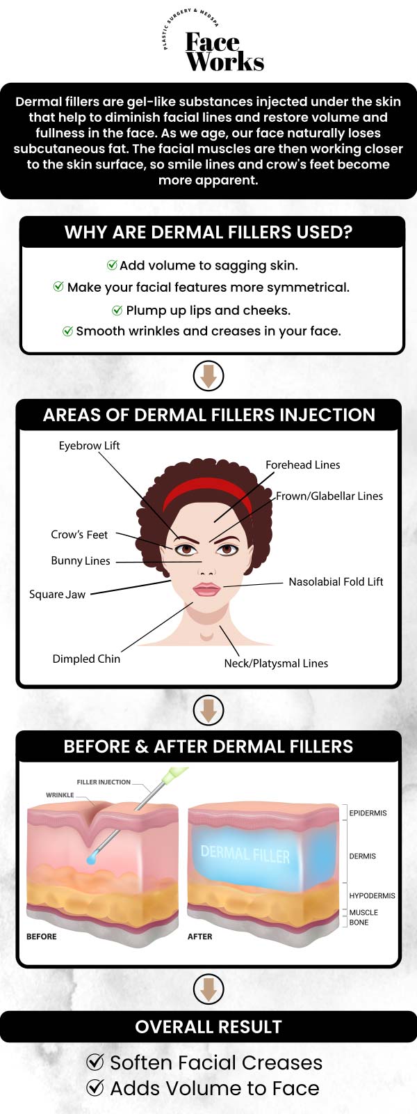 Common questions asked by patients: What exactly are dermal fillers, and how do they work to restore a youthful appearance? What's the difference between dermal fillers and Botox? Can they be used together? How are facial fillers different from surgical procedures like a facelift? What specific areas of the face can be treated with dermal fillers? What happens during a consultation for dermal fillers? For more information, contact us or request an appointment online. We serve patients from Schaumburg IL, Hoffman Estates IL, Rolling Meadows IL, Hanover Park IL, Streamwood IL, Elk Grove Village IL, and surrounding areas.