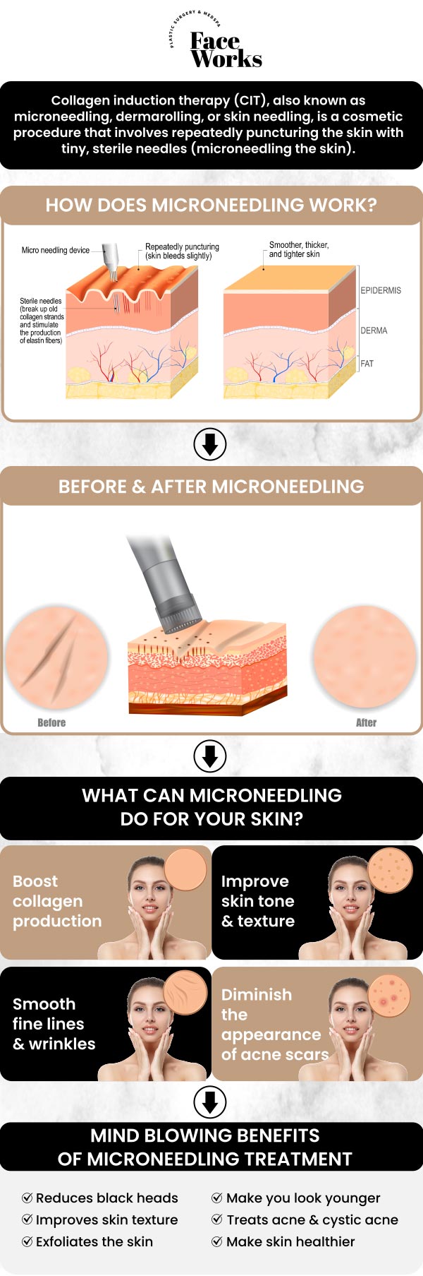 PRP microneedling is a cutting-edge treatment that combines microneedling with platelet-rich plasma (PRP) to rejuvenate the skin and reduce signs of aging. By stimulating collagen production it helps minimize wrinkles, scars, and fine lines. Under the expert care of our specialists, you can achieve refreshed, youthful skin with personalized treatment tailored to your needs. For more information, contact us or request an appointment online. We are conveniently located at 501 W Golf Rd A, Schaumburg, IL 60195.