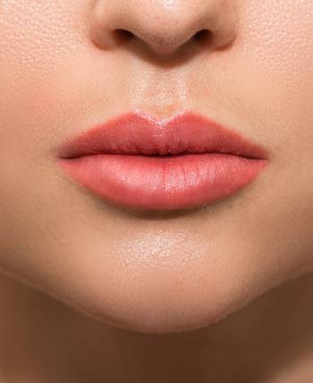 Temporary Fillers Full Syringe Near Me in Schaumburg, IL Temporary Fillers Full Syringe Near Me in Schaumburg, IL