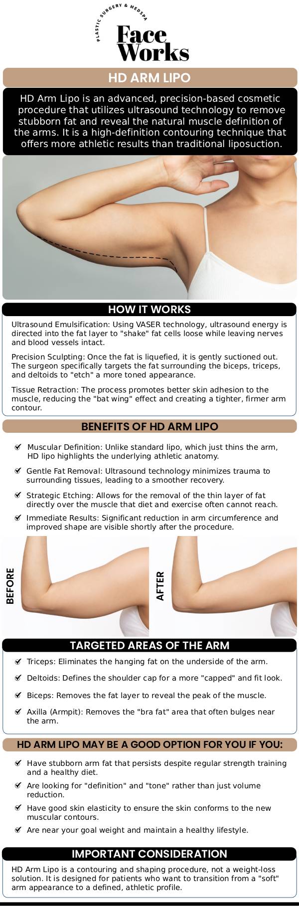 Our team at Face Works Plastic Surgery offers HD Arm LIPO, a precision body contouring procedure that targets stubborn fat in the arms for a sleek, toned look. Using advanced techniques, Dr. Dillon helps patients achieve a more sculpted arm appearance, with results that are natural, smooth, and long-lasting. For more information, contact us or book an appointment online. We are conveniently located at 501 W Golf Rd A, Schaumburg, IL 60195.