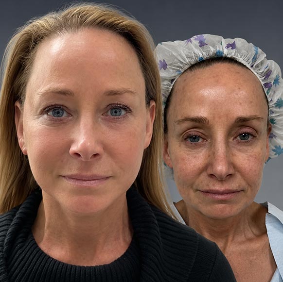 AwakeTight™ at Face Works Plastic Surgery, Plastic Surgeon Near Me in Schaumburg,