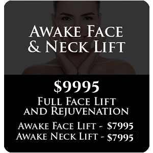 Awake Face & Neck Lift Awake Face & Neck Lift